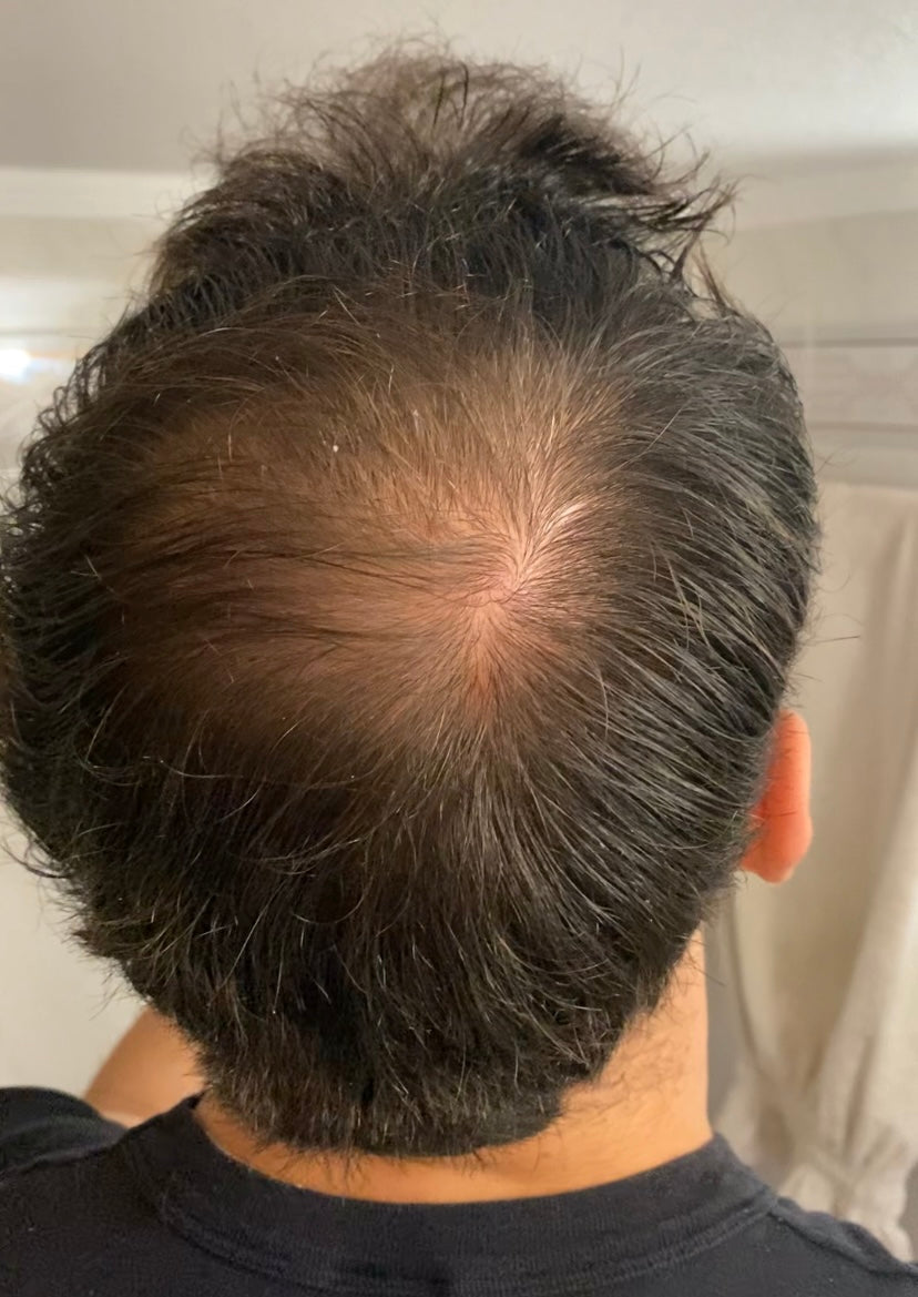 Hair before applying Rooty 2.0