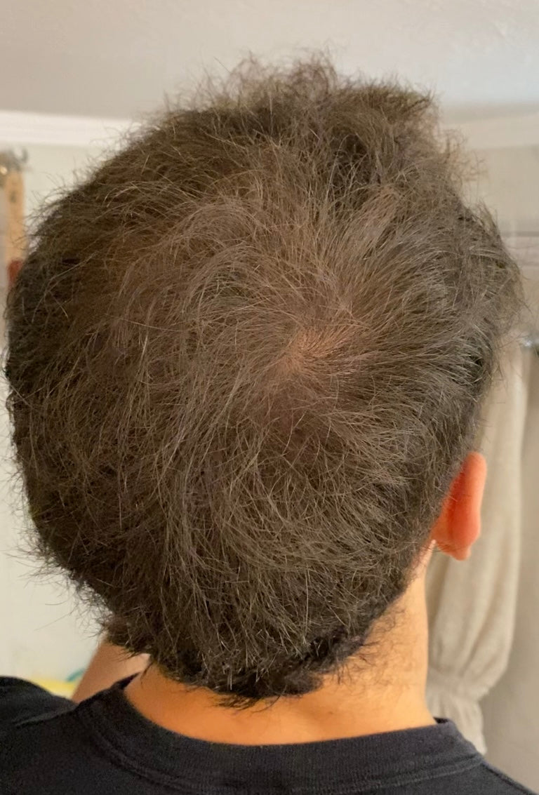 Hair after applying Rooty 2.0