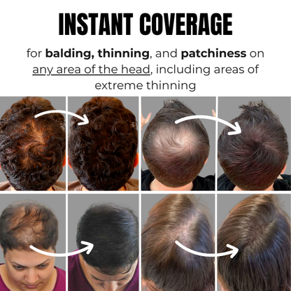 Rooty 2.0 Hair Loss Powder