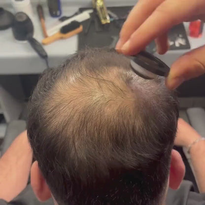 Rooty 2.0 Hair Loss Powder